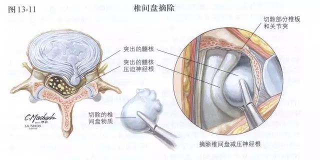 1561338287586889.jpg 22.jpg